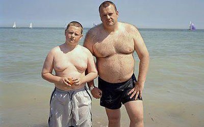 Ожирение у детей фото